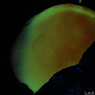 CLSM Aufnahme von Tasmanites (fossile, einzellige Alge). Punktförmige Öffnungen im Mikrometerbereich mit maximaler Emissionsintensität an den Rändern